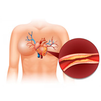 neurosurgeons in India