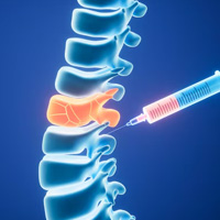 neurosurgeons in India