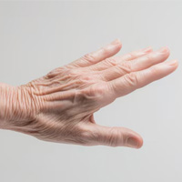 neurosurgeons in India