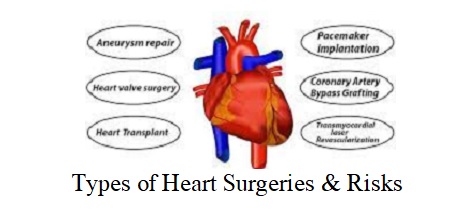 Heart Surgery Types and Risks
