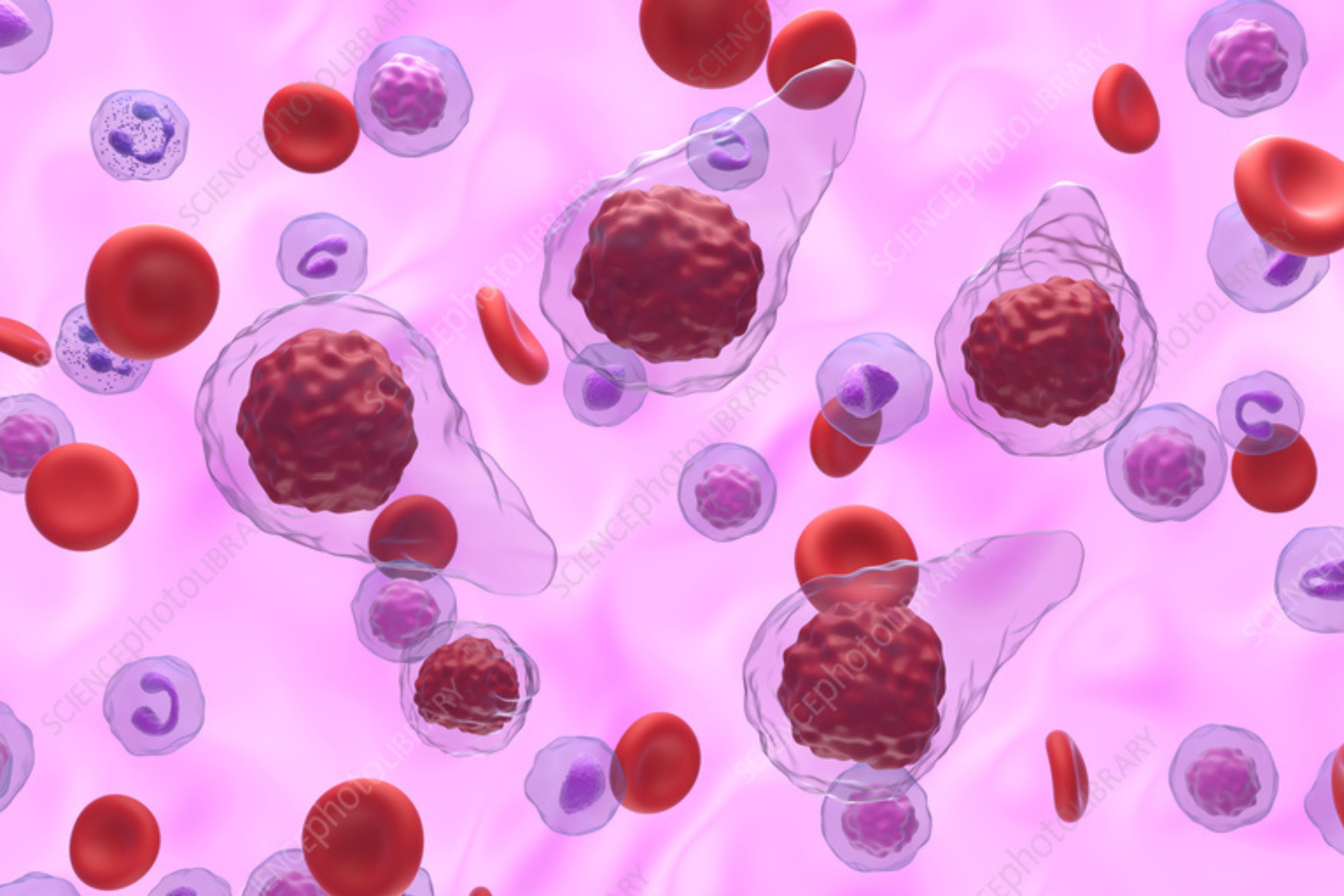 Myelofibrosis Treatment